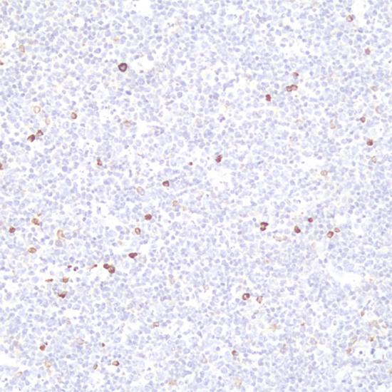 Réactif d'anticorps IgM pour l'immunohistochimie