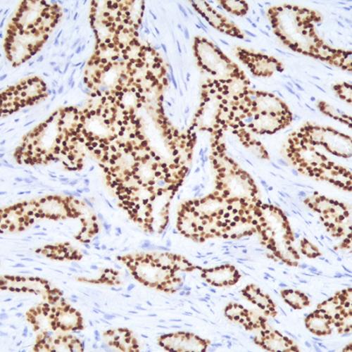 Estrogen Receptors (ER) Antibody Reagent for Immunohistochemistry