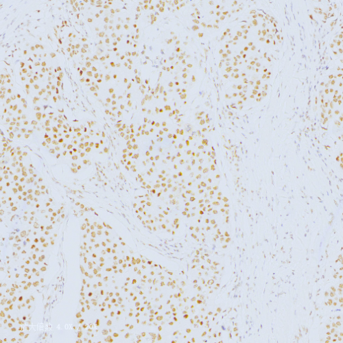 INI-1 Antibody Reagent for Immunohistochemistry